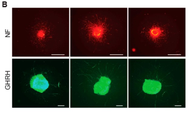 Illustrative images of dual IHC for the axons of total arcuate nucleus neurons labeled with NF and GHRH neurons labeled with eGFP.jpg